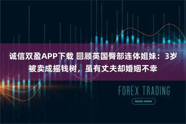 诚信双盈APP下载 回顾英国臀部连体姐妹：3岁被卖成摇钱树，虽有丈夫却婚姻不幸